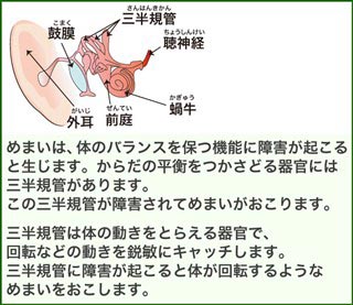 �߂܂��́A�̂̃o�����X��ۂ@�\�ɏ�Q���N����Ɛ����܂��B���炾�̕��t�������ǂ�튯�ɂ͎O���K�ǂ�����܂��B<br />���̎O���K�ǂ���Q����Ă߂܂���������܂��B�O���K�ǂ͑̂̓������Ƃ炦��튯�ŁA��]�Ȃǂ̓������s�q�ɃL���b�`���܂��B�O���K�ǂɏ�Q���N����Ƒ̂���]����悤��<br />�߂܂����������܂��B