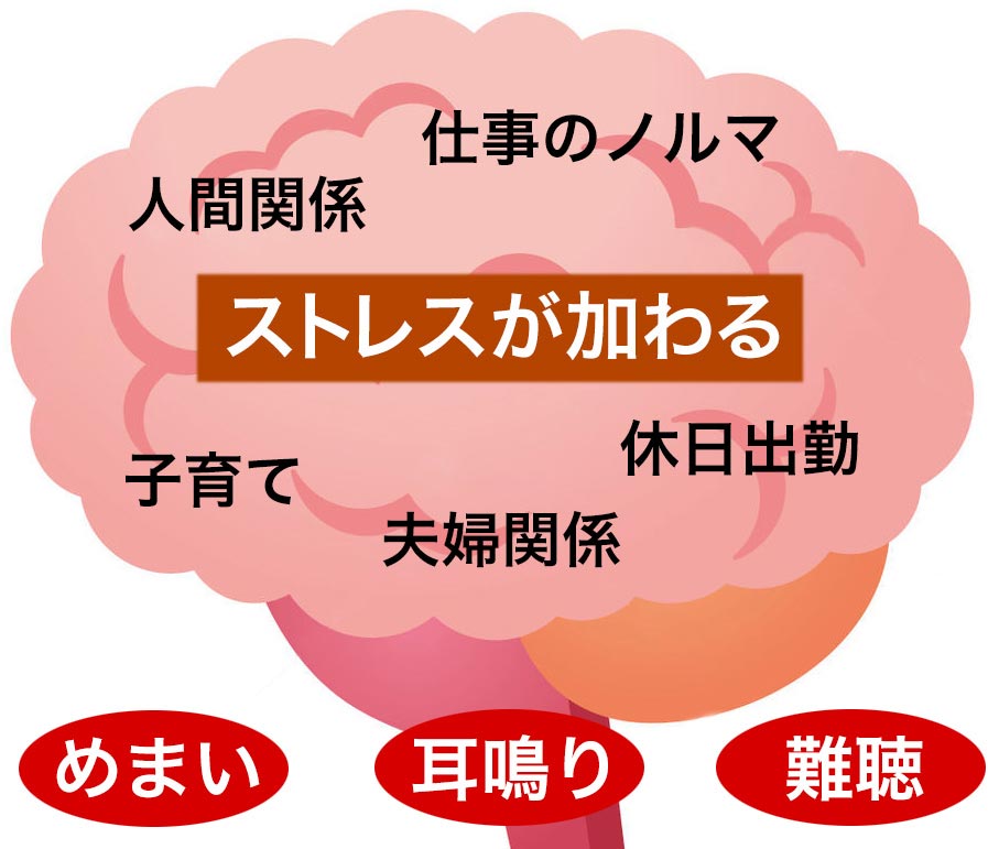 �����_�o�̓X�g���X�������ŗ���邱�Ƃ�